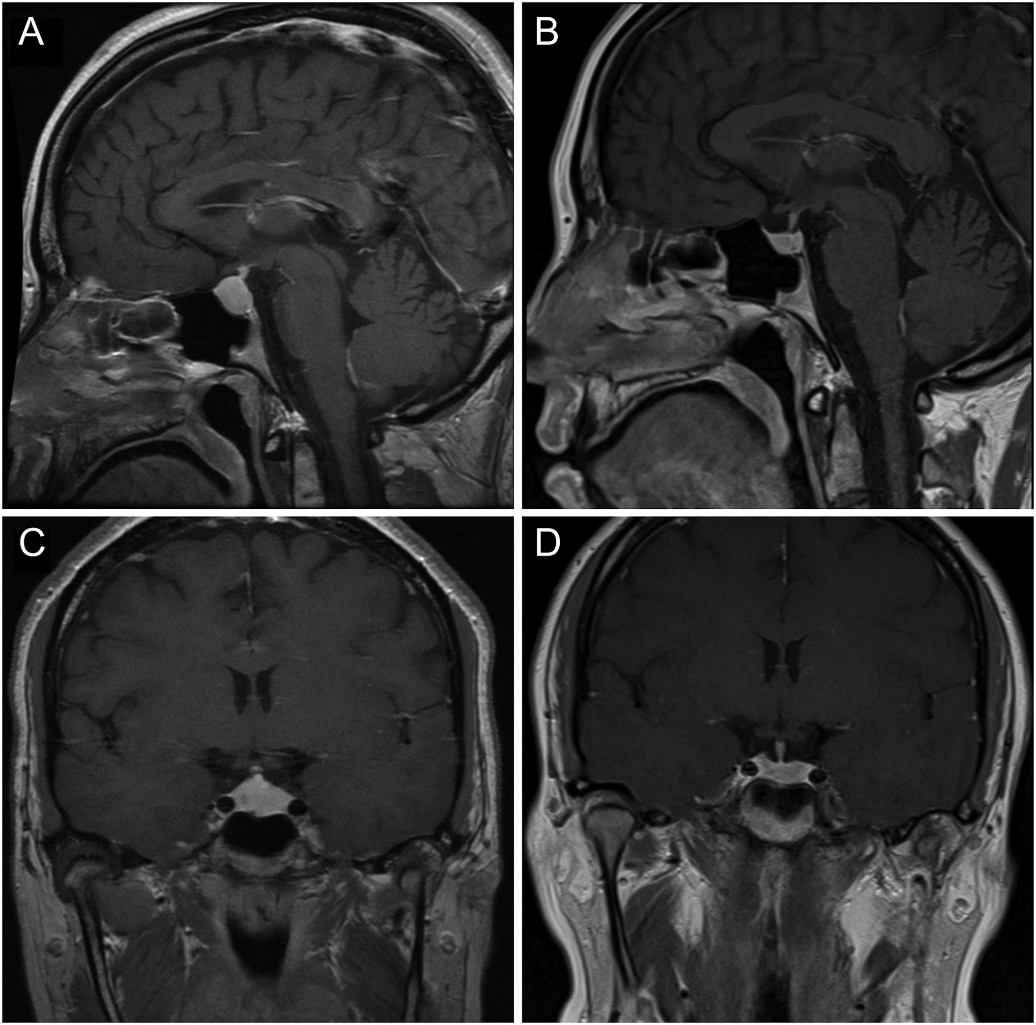 【佳学基因检测】讯飞星火认知大模型中COL16A1基因评估分析知识信息源分析